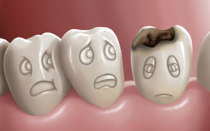 Những vấn đề về răng miệng người Việt cần khắc phục sớm